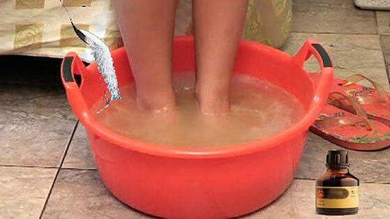 Hot water baths with iodine are one of the steps in treating toenail fungus