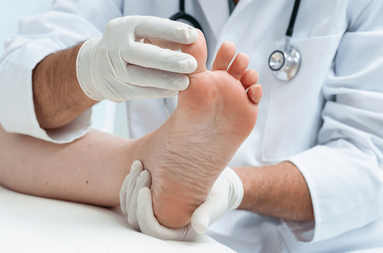 Treatment of nail mushrooms