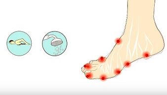 Causes of fungus in toes