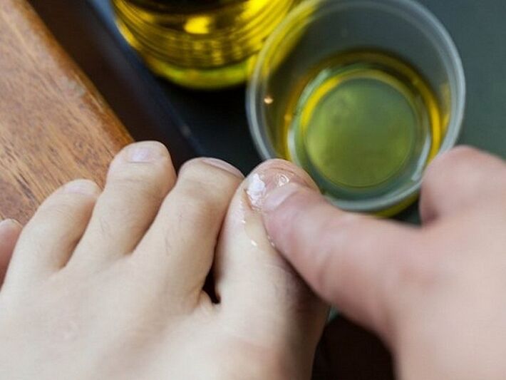 Apply medicated oil to the fungal nail
