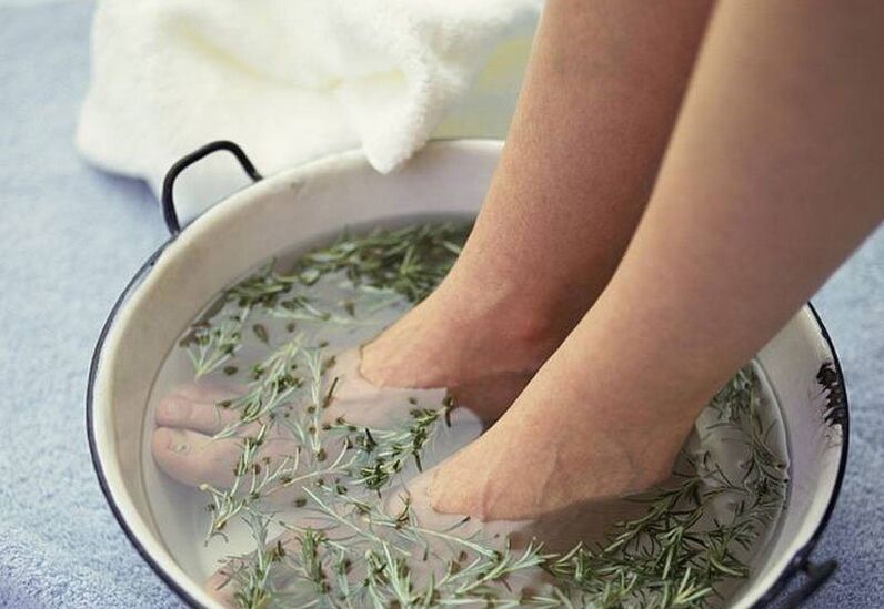 Take a bath with a decoction to treat toenail fungus