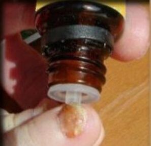 Drop the medicine on the toenail with fungus