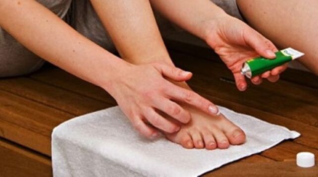 Treat toenail fungus with ointment